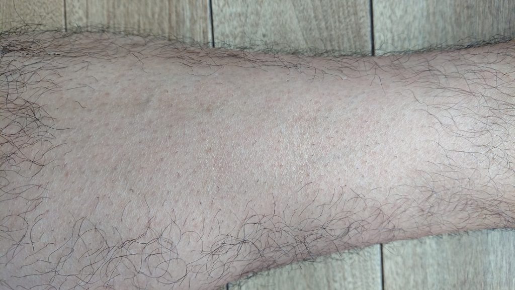 家庭用レーザー脱毛器使用の6週間後の足